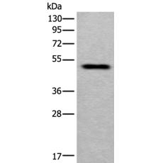 兔抗MMP12多克隆抗體