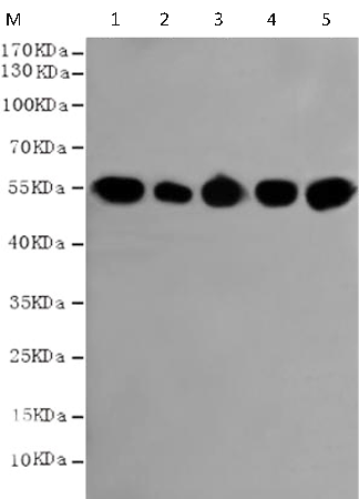 小鼠抗TUBB(HRP-Conjugate)單克隆抗體