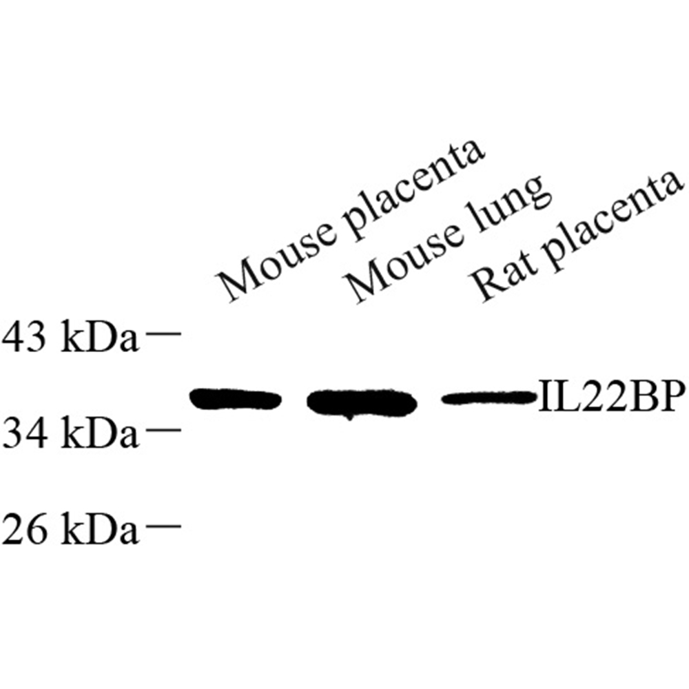 Anti -IL22 RA2/IL- 22BP Rabbit pAb