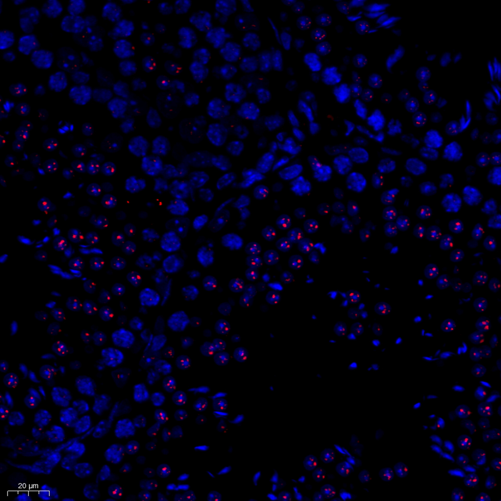 Anti -TCPTP Rabbit pAb