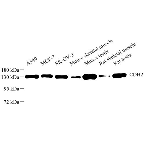 Anti -N Cadherin Rabbit pAb